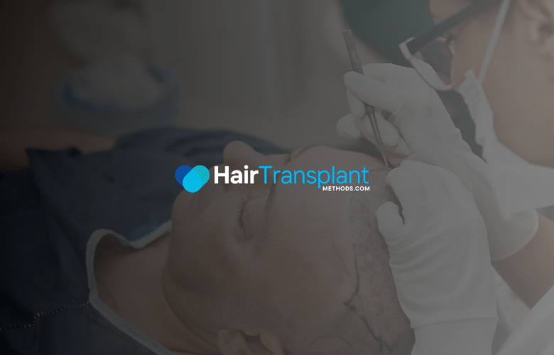 Best Hair Transplant Results